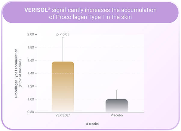 All Nutrition Alldeynn Collarose 300g