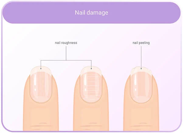 All Nutrition Alldeynn Collarose 300g