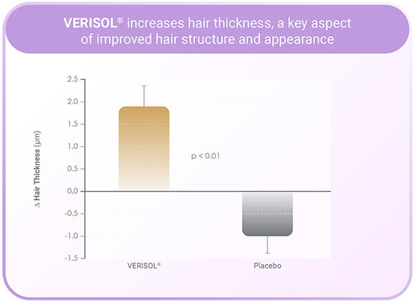 All Nutrition Alldeynn Collarose 300g